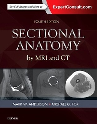 Sectional Anatomy by MRI and CT - 9780323934480 | Elsevier