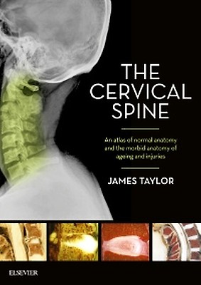 Operative Techniques: Spine Surgery - 9780323938198
