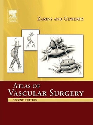 Atlas of Vascular Surgery and Endovascular Therapy - 9780323566940