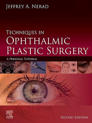 Colour Atlas of Ophthalmic Plastic Surgery - 9780323476799
