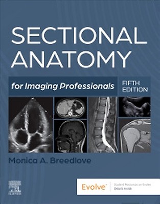 健康・医学 MRI ARTHROSCOPY and SURGICAL ANATOMY MRI ARTHROSCOPY and SURGICAL ANATOMY