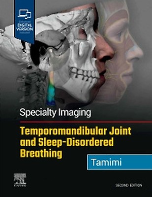 Management of Temporomandibular Disorders and Occlusion