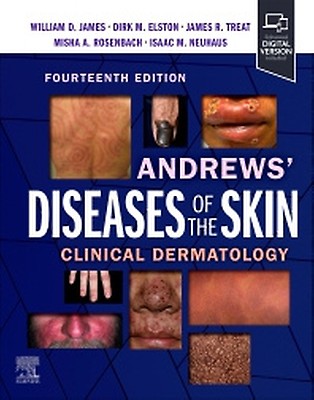 Lookingbill & Marks' Principles of Dermatology - 9780323934244