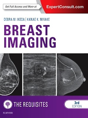 Breast Imaging - 9780323758499