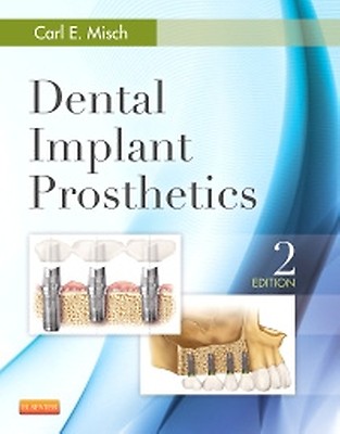 Misch's Contemporary Implant Dentistry - 9780323391559 | Elsevier