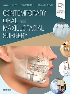 Atlas of Oral and Maxillofacial Surgery - 2 Volume SET - 9780323789639