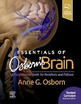 Osborn's Brain - 9780443109379