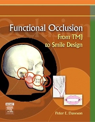 Functional Occlusion in Restorative Dentistry an: 1st edition