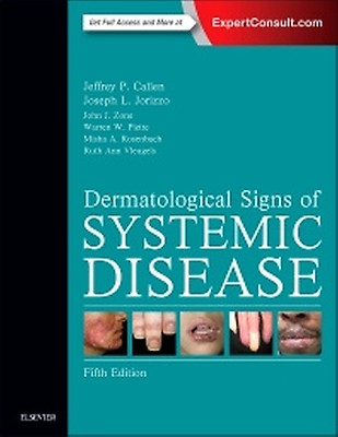 Dubois' Lupus Erythematosus and Related Syndrome: 10th edition