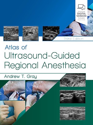 Atlas of Pediatric Laparoscopy and Thoracoscopy: 2nd edition