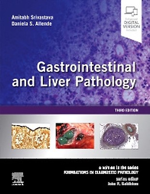 MacSween's Pathology of the Liver: 8th edition | Alastair D. Burt