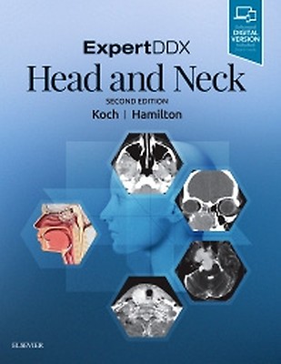 ExpertDDx: Brain and Spine: 3rd edition | Karen L. Salzman | ISBN