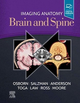 Essentials of Osborn's Brain: 1st edition | Anne G. Osborn | ISBN
