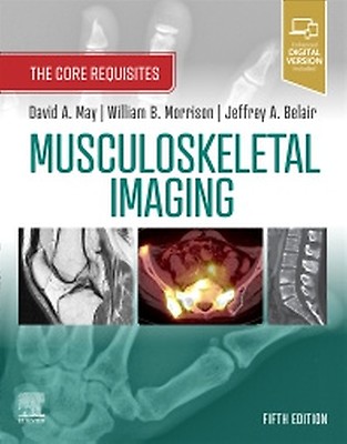 Musculoskeletal MRI: 3rd edition | Nancy M. Major | ISBN