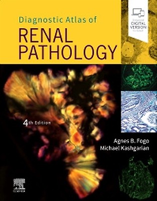 Diagnostic Pathology: Kidney Diseases: 4th edition | Robert B