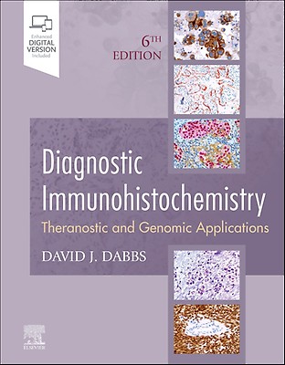 Diagnostic Histopathology of Tumors, 2 Volume Se: 5th edition 