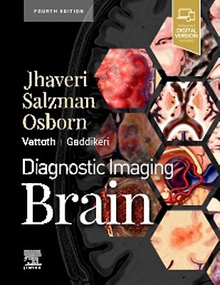 【美品・電子版使用済】Diagnostic Imaging: Brain 脳画像 美品・電子版使用済】Diagnostic Imaging: Brain 脳画像 美品
