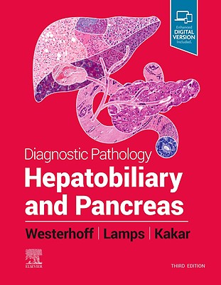 Diagnostic Pathology: Lymph Nodes and Extranodal: 3rd edition | L ...