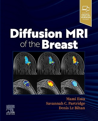 Amazon | Diseases of the Breast | Harris, Jay R., Lippman