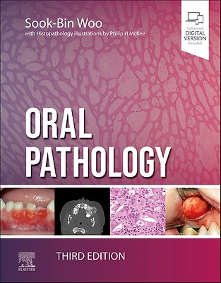 Diagnostic Histopathology of Tumors, 2 Volume Se: 5th edition 