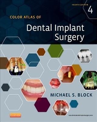 Dental Implants: 2nd edition | Charles A. Babbush | ISBN