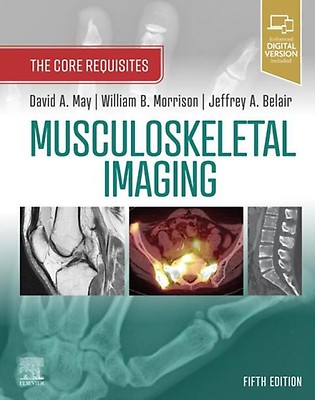 裁断済 Diagnostic Imaging: Musculoskeletal 31MJfw9tuTL._UF350,350_QL80_.jpg