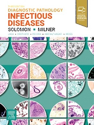 Diagnostic Pathology: Kidney Diseases: 4th edition | Robert