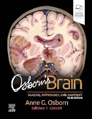 【美品・電子版使用済】Diagnostic Imaging: Brain 脳画像 Diagnostic Imaging: Brain: 5th edition | Karen L. Salzman