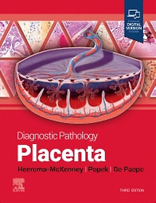 Diagnostic Pathology: Gynecological: 9780443104565: Medicine