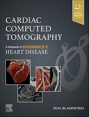 BRAUNWALD'S HEART DISEASE 12th 1,2巻 Braunwald's Heart Disease: International Edition: 12th
