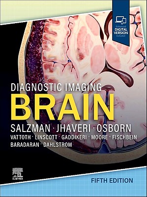Diagnostic Imaging: Brain: 4th edition | Miral D. Jhaveri