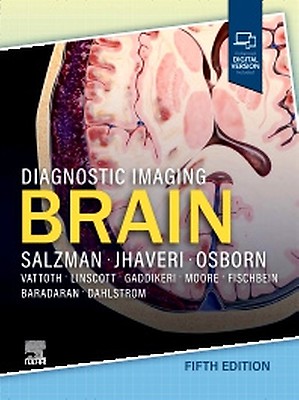 Osborn's Brain: 3rd edition | Anne G. Osborn | ISBN: 9780443109379