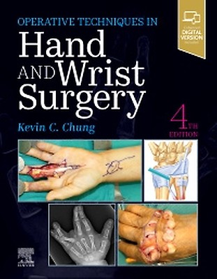 Operative Techniques: Hand and Wrist Surgery - 9780323794152