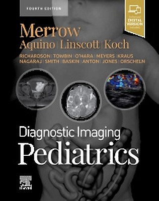 Diagnostic Imaging: Chest - 9780323796637