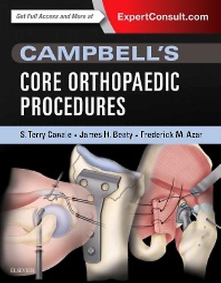Campbell's Operative Orthopaedics, 4-Volume Set - 9780443117633