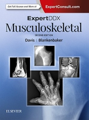 洋書 Expert ddx brain and spine ExpertDDx: Brain and Spine: 9780443106941: Medicine & Health