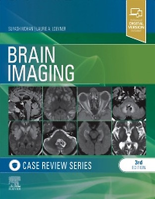 Radiology Review Books, eBooks & Journals | US Elsevier Health