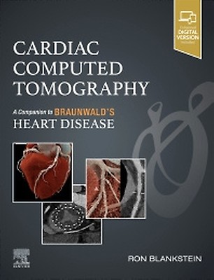 Cardiac Computed Tomography