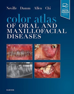 Atlas of Oral and Maxillofacial Surgery - 2 Volu: 2nd edition
