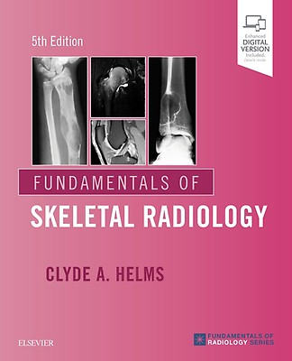 Elsevier Head and Neck Imaging Fifth Edition Volume 1 2011 PeterM.Som・HughD.Curtin 080LaD Head and Neck Imaging (Expert Consult): 9780323053556