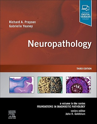 Memory Loss，Alzheimer&#39;s Disease and Dementia: A Practical Guide for Clinicians [ペーパーバック] Budson MD，Andrew E.; Solomon PhD，Paul R. Memory Loss, Alzheimer's Disease and Dementia: A Practical