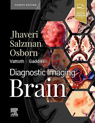 Osborn's Brain:他合わせて5冊