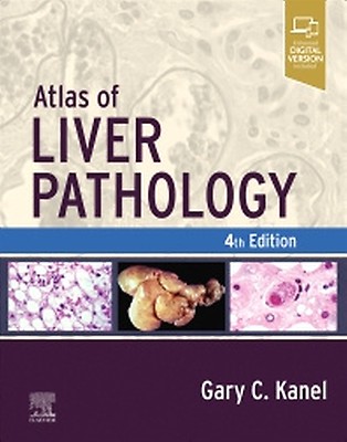 MacSween's Pathology of the Liver: 8th edition | Alastair D. Burt