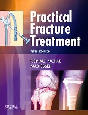 Fracture Management for Primary Care Updated Edition Eiff MD， M. Patrice; Hatch MD  MPH， Robert L. Fracture Management for Primary Care and Emergency Medicine
