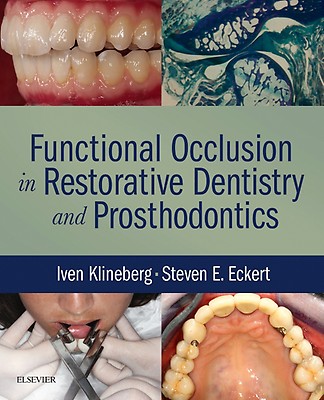 Functional Occlusion: 1st edition | Peter E. Dawson | ISBN