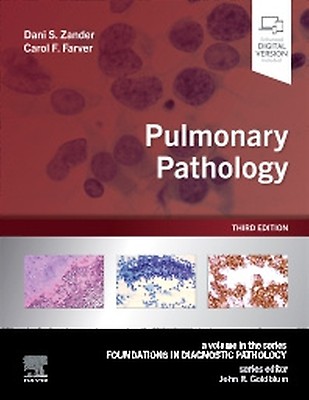 Diagnostic Pathology: Kidney Diseases: 4th edition | Robert