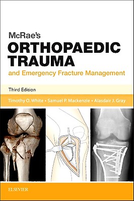 Fracture Management for Primary Care Updated Edition Eiff MD， M. Patrice; Hatch MD  MPH， Robert L. Fracture Management for Primary Care Updated Edition