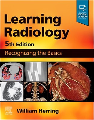 Felson's Principles of Chest Roentgenology, A Pr