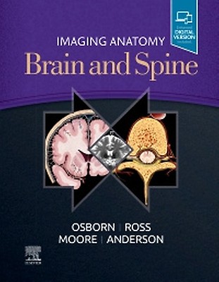 健康・医学 DIAGNOSTIC IMAGING BRAIN Diagnostic Imaging: Brain: Jhaveri MD MBA, Miral D