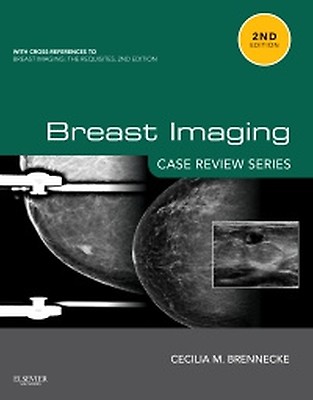 Breast Imaging - 9780323758499 | Elsevier Health